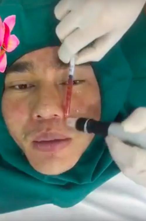 Lê Dương Bảo Lâm: Tôi cắt mí, sửa mũi, độn cằm... chỉ duy nhất lỗ tai là chưa động vào dao kéo - Ảnh 3.